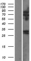 RTBDN / Retbindin Protein - Western validation with an anti-DDK antibody * L: Control HEK293 lysate R: Over-expression lysate