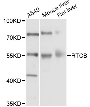 RTCB / C22orf28 Antibody - Western blot analysis of extracts of various cell lines, using RTCB antibody at 1:1000 dilution. The secondary antibody used was an HRP Goat Anti-Rabbit IgG (H+L) at 1:10000 dilution. Lysates were loaded 25ug per lane and 3% nonfat dry milk in TBST was used for blocking. An ECL Kit was used for detection and the exposure time was 10s.