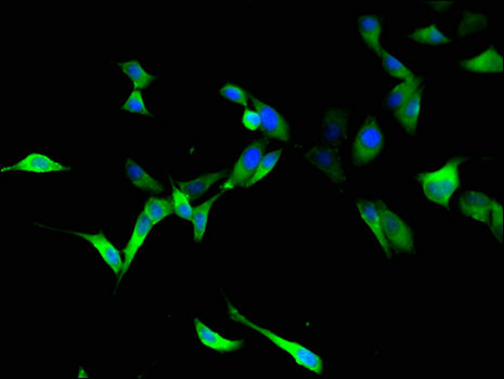RTCB / C22orf28 Antibody - Immunofluorescent analysis of Hela cells using RTCB Antibody at a dilution of 1:100 and Alexa Fluor 488-congugated AffiniPure Goat Anti-Rabbit IgG(H+L)