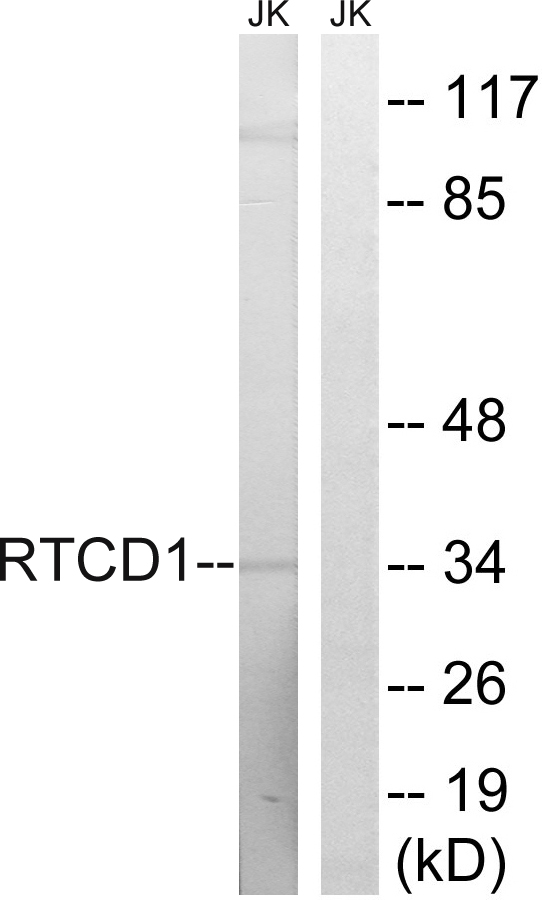 RTCD1 / RPC Antibody - Western blot analysis of lysates from Jurkat cells, using RTCD1 Antibody. The lane on the right is blocked with the synthesized peptide.