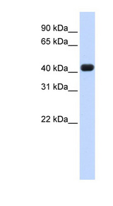 RTCD1 / RPC Antibody - RTCD1 antibody Western blot of Fetal Heart lysate. This image was taken for the unconjugated form of this product. Other forms have not been tested.