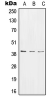 RTCD1 / RPC Antibody - Western blot analysis of RPC expression in HeLa (A); NIH3T3 (B); rat stomach (C) whole cell lysates.