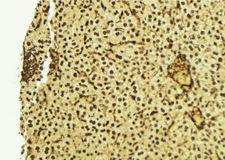 RTCD1 / RPC Antibody - 1:100 staining mouse liver tissue by IHC-P. The sample was formaldehyde fixed and a heat mediated antigen retrieval step in citrate buffer was performed. The sample was then blocked and incubated with the antibody for 1.5 hours at 22°C. An HRP conjugated goat anti-rabbit antibody was used as the secondary.