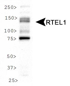 RTEL1 Antibody - Western Blot: RTEL1 Antibody - WB analysis of RTEL1 in HeLa cell lysate.  This image was taken for the unconjugated form of this product. Other forms have not been tested.