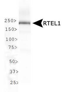 RTEL1 Antibody - Western Blot: RTEL1 Antibody - WB analysis of RTEL1 in mouse testis lysate.  This image was taken for the unconjugated form of this product. Other forms have not been tested.