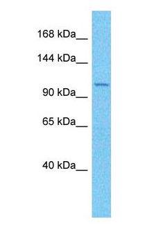 RTEL1 Antibody - Western blot of RTEL1 Antibody with human MCF7 Whole Cell lysate.  This image was taken for the unconjugated form of this product. Other forms have not been tested.