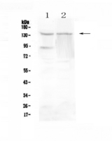 RTEL1 Antibody - Western blot - Anti-RTEL1 antibody
