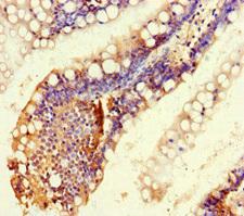 RTEL1 Antibody - Immunohistochemistry of paraffin-embedded human small intestine tissue at dilution of 1:100