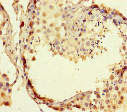RTEL1 Antibody - Immunohistochemistry of paraffin-embedded human testis tissue at dilution of 1:100