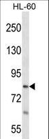 RTF1 Antibody - RTF1 Antibody western blot of HL-60 cell line lysates (35 ug/lane). The RTF1 antibody detected the RTF1 protein (arrow).