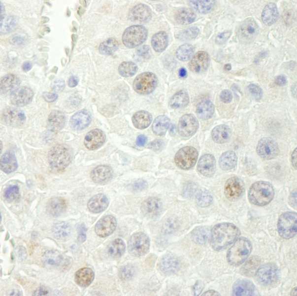 RTF1 Antibody - Detection of Mouse Rtf1 by Immunohistochemistry. Sample: FFPE section of mouse renal cell carcinoma. Antibody: Affinity purified rabbit anti-Rtf1 used at a dilution of 1:250.