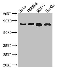 RTF1 Antibody - Western Blot Positive WB detected in:Hela whole cell lysate,HEK293 whole cell lysate,MCF-7 whole cell lysate,HepG2 whole cell lysate All Lanes: RTF1 antibody at 3.4ug/ml Secondary Goat polyclonal to rabbit IgG at 1/50000 dilution Predicted band size: 81 kDa Observed band size: 81 kDa