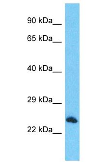 RTFDC1 Antibody - RTFDC1 antibody Western Blot of HepG2. Antibody dilution: 1 ug/ml.  This image was taken for the unconjugated form of this product. Other forms have not been tested.