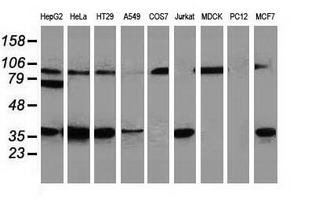 RTFDC1 Antibody - Western blot of extracts (35ug) from 9 different cell lines by using anti-C20orf43 monoclonal antibody.