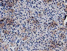 RTFDC1 Antibody - IHC of paraffin-embedded Human pancreas tissue using anti-C20orf43 mouse monoclonal antibody. (Heat-induced epitope retrieval by 10mM citric buffer, pH6.0, 100C for 10min).
