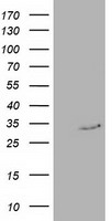 RTFDC1 Antibody - HEK293T cells were transfected with the pCMV6-ENTRY control (Left lane) or pCMV6-ENTRY C20orf43 (Right lane) cDNA for 48 hrs and lysed. Equivalent amounts of cell lysates (5 ug per lane) were separated by SDS-PAGE and immunoblotted with anti-C20orf43.