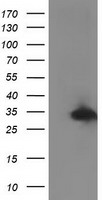 RTFDC1 Antibody - HEK293T cells were transfected with the pCMV6-ENTRY control (Left lane) or pCMV6-ENTRY C20orf43 (Right lane) cDNA for 48 hrs and lysed. Equivalent amounts of cell lysates (5 ug per lane) were separated by SDS-PAGE and immunoblotted with anti-C20orf43.