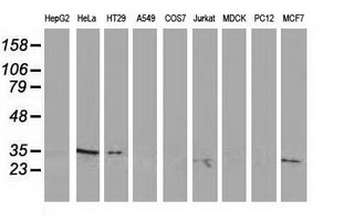 RTFDC1 Antibody - Western blot of extracts (35 ug) from 9 different cell lines by using anti-C20orf43 monoclonal antibody.