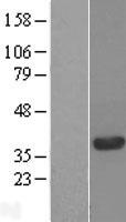 RTFDC1 Protein - Western validation with an anti-DDK antibody * L: Control HEK293 lysate R: Over-expression lysate