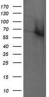 RTKN / Rhotekin Antibody - HEK293T cells were transfected with the pCMV6-ENTRY control (Left lane) or pCMV6-ENTRY RTKN (Right lane) cDNA for 48 hrs and lysed. Equivalent amounts of cell lysates (5 ug per lane) were separated by SDS-PAGE and immunoblotted with anti-RTKN.
