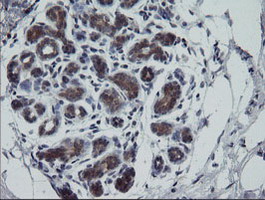 RTKN / Rhotekin Antibody - IHC of paraffin-embedded Human breast tissue using anti-RTKN mouse monoclonal antibody. (Heat-induced epitope retrieval by 10mM citric buffer, pH6.0, 100C for 10min).