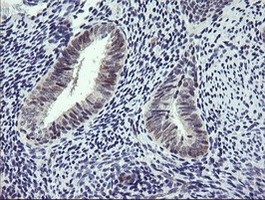 RTKN / Rhotekin Antibody - IHC of paraffin-embedded Human endometrium tissue using anti-RTKN mouse monoclonal antibody. (Heat-induced epitope retrieval by 10mM citric buffer, pH6.0, 100C for 10min).