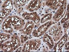 RTKN / Rhotekin Antibody - IHC of paraffin-embedded Human Kidney tissue using anti-RTKN mouse monoclonal antibody.