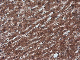 RTKN / Rhotekin Antibody - IHC of paraffin-embedded Human liver tissue using anti-RTKN mouse monoclonal antibody.