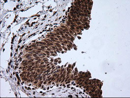 RTKN / Rhotekin Antibody - IHC of paraffin-embedded Human bladder tissue using anti-RTKN mouse monoclonal antibody.