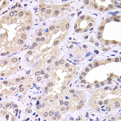 RTKN / Rhotekin Antibody - Immunohistochemistry of paraffin-embedded human kidney tissue.