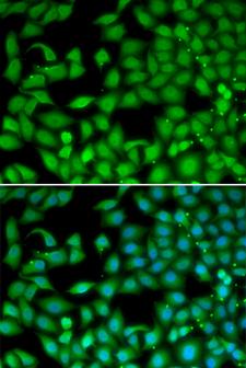 RTKN / Rhotekin Antibody - Immunofluorescence analysis of MCF7 cells.