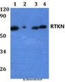 RTKN / Rhotekin Antibody - Western blot of RTKN antibody at 1:500 dilution. Lane 1: HEK293T whole cell lysate. Lane 2: Raw264.7 whole cell lysate. Lane 3: PC12 whole cell lysate. Lane 4: HeLa whole cell lysate.