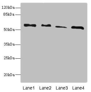 RTKN / Rhotekin Antibody - Western blot All Lanes: RTKN antibody at 4.66ug/ml Lane 1: A431 whole cell lysate Lane 2: HepG-2 whole cell lysate Lane 3: MCF7 whole cell lysate Lane 4: Mouse brain tissue Secondary Goat polyclonal to rabbit IgG at 1/10000 dilution Predicted band size: 63,62,57 kDa Observed band size: 63 kDa