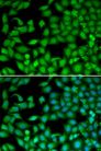 RTKN / Rhotekin Antibody - Immunofluorescence analysis of MCF-7 cells using RTKN antibody. Blue: DAPI for nuclear staining.