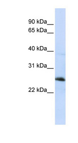 RTN1 / Reticulon 1 Antibody - RTN1 / Reticulon 1 antibody Western blot of Jurkat lysate. This image was taken for the unconjugated form of this product. Other forms have not been tested.