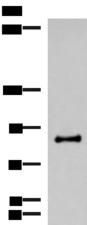 RTN1 / Reticulon 1 Antibody - Western blot analysis of Mouse brain tissue lysate  using RTN1 Polyclonal Antibody at dilution of 1:600