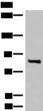 RTN1 / Reticulon 1 Antibody - Western blot analysis of Mouse brain tissue lysate  using RTN1 Polyclonal Antibody at dilution of 1:400