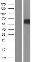 RTN2 / Reticulon 2 Protein - Western validation with an anti-DDK antibody * L: Control HEK293 lysate R: Over-expression lysate