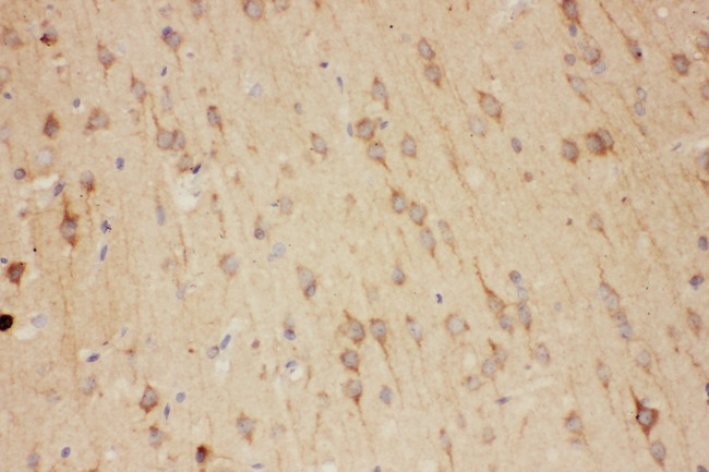 RTN3 / Reticulon 3 Antibody - RTN3 / Reticulon 3 antibody. IHC(P): Rat Brain Tissue.