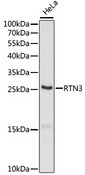 RTN3 / Reticulon 3 Antibody - Western blot analysis of extracts of HeLa cells, using RTN3 antibody at 1:1000 dilution. The secondary antibody used was an HRP Goat Anti-Rabbit IgG (H+L) at 1:10000 dilution. Lysates were loaded 25ug per lane and 3% nonfat dry milk in TBST was used for blocking. An ECL Kit was used for detection and the exposure time was 90s.