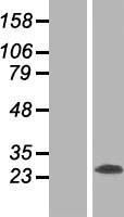 RTN3 / Reticulon 3 Protein - Western validation with an anti-DDK antibody * L: Control HEK293 lysate R: Over-expression lysate