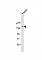 RTN4 / Nogo Antibody - Anti-RTN4 Antibody (N-Term) at 1:2000 dilution + human brain lysate Lysates/proteins at 20 ug per lane. Secondary Goat Anti-Rabbit IgG, (H+L), Peroxidase conjugated at 1:10000 dilution. Predicted band size: 130 kDa. Blocking/Dilution buffer: 5% NFDM/TBST.