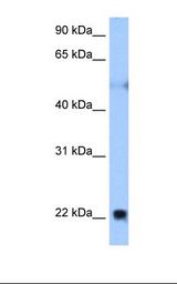 RTN4 / Nogo Antibody - Fetal muscle cell lysate. Antibody concentration: 0.25 ug/ml. Gel concentration: 12%.  This image was taken for the unconjugated form of this product. Other forms have not been tested.
