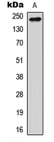 RTN4 / Nogo Antibody - Western blot analysis of Nogo expression in HEK293T (A) whole cell lysates.
