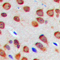 RTN4 / Nogo Antibody - Immunohistochemical analysis of Nogo staining in human brain formalin fixed paraffin embedded tissue section. The section was pre-treated using heat mediated antigen retrieval with sodium citrate buffer (pH 6.0). The section was then incubated with the antibody at room temperature and detected using an HRP-conjugated compact polymer system. DAB was used as the chromogen. The section was then counterstained with hematoxylin and mounted with DPX.