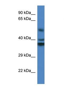 RTN4IP1 / NIMP Antibody - RTN4IP1 antibody Western blot of Fetal Kidney lysate. Antibody concentration 1 ug/ml.  This image was taken for the unconjugated form of this product. Other forms have not been tested.
