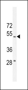 RTN4IP1 / NIMP Antibody - RT4I1 Antibody western blot of WiDr cell line lysates (35 ug/lane). The RT4I1 antibody detected the RT4I1 protein (arrow).
