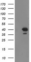 RTN4IP1 / NIMP Antibody - HEK293T cells were transfected with the pCMV6-ENTRY control (Left lane) or pCMV6-ENTRY RTN4IP1 (Right lane) cDNA for 48 hrs and lysed. Equivalent amounts of cell lysates (5 ug per lane) were separated by SDS-PAGE and immunoblotted with anti-RTN4IP1.