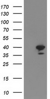 RTN4IP1 / NIMP Antibody - HEK293T cells were transfected with the pCMV6-ENTRY control (Left lane) or pCMV6-ENTRY RTN4IP1 (Right lane) cDNA for 48 hrs and lysed. Equivalent amounts of cell lysates (5 ug per lane) were separated by SDS-PAGE and immunoblotted with anti-RTN4IP1.