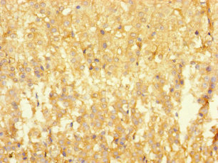 RTN4IP1 / NIMP Antibody - Immunohistochemistry of paraffin-embedded human adrenal gland tissue using RTN4IP1 Antibody at dilution of 1:100